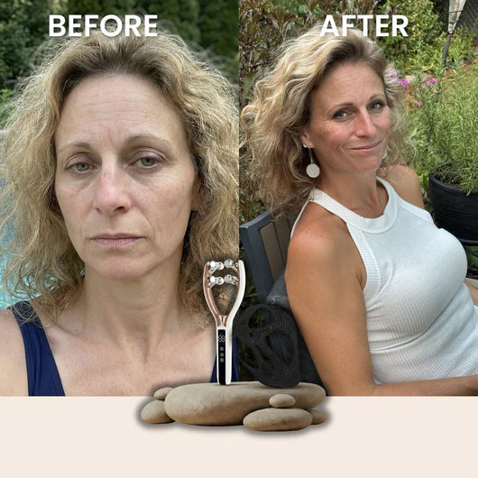 Celyx Facial Massager