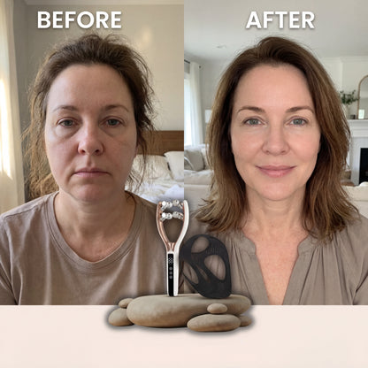 Celyx Facial Massager