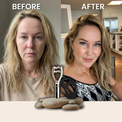 Celyx Facial Massager