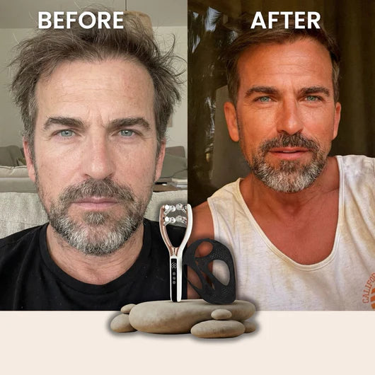 Celyx Facial Massager